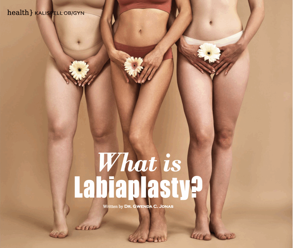 What is Labiaplasty
