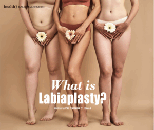 What is Labiaplasty