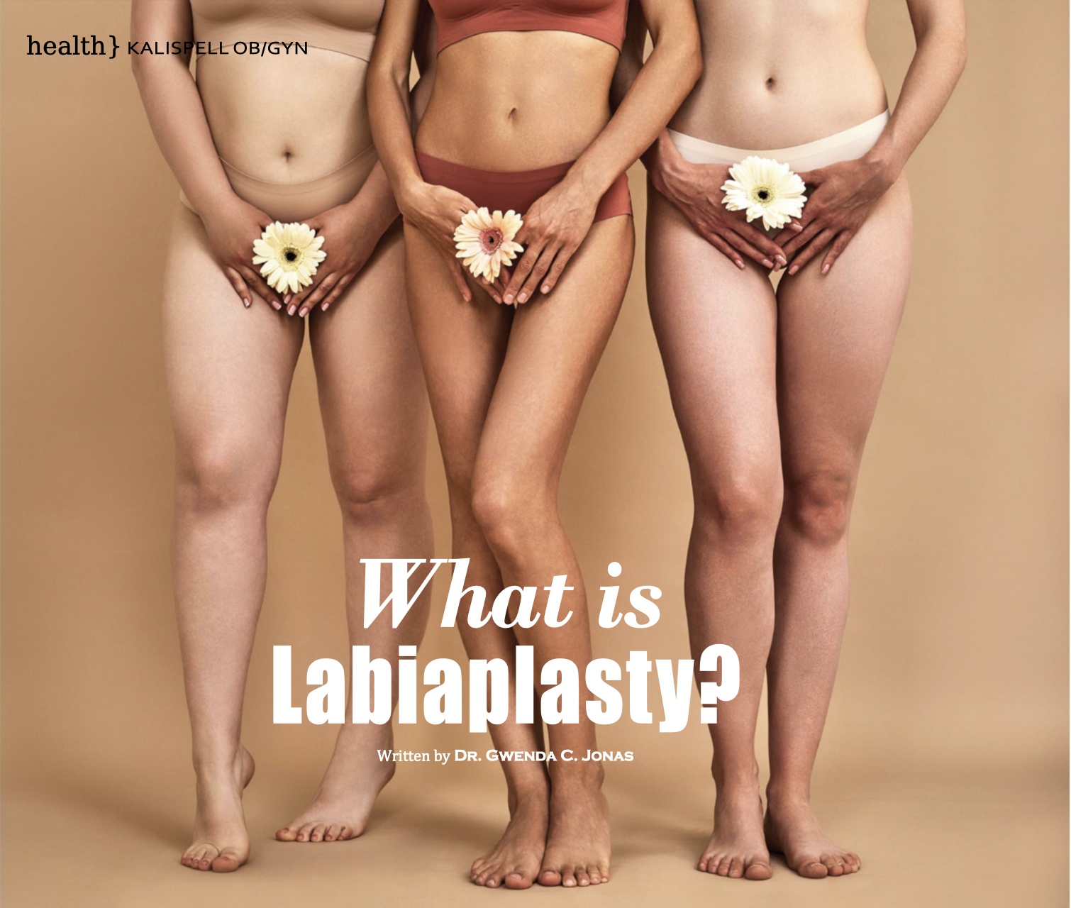 What is Labiaplasty - Dr. Gwenda C. Jonas